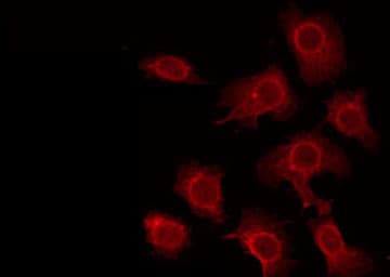 STK33 Antibody