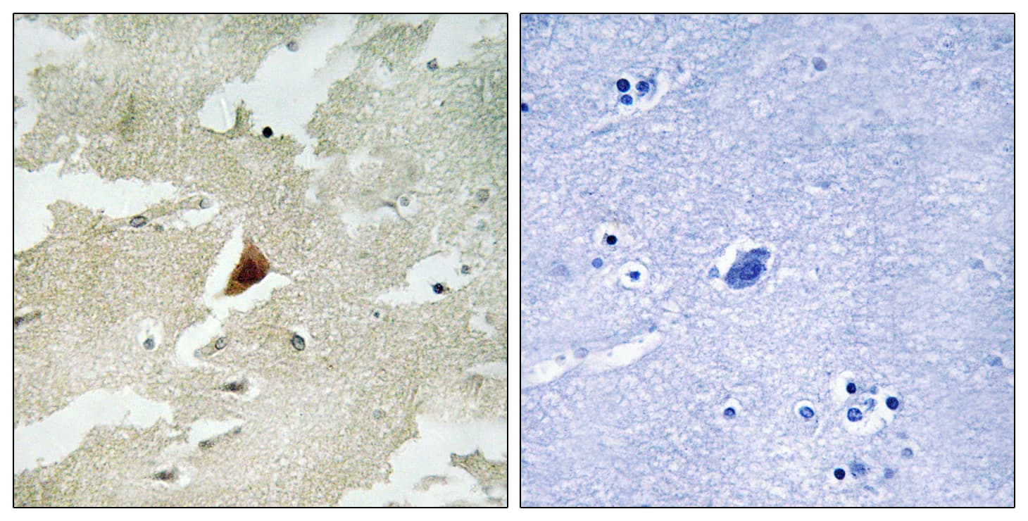 MAPKAPK5 / PRAK Antibody (aa171-220)