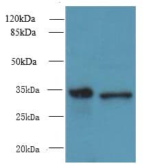 RWDD2A Antibody
