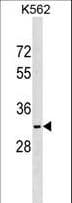 Polyclonal Rabbit anti-Human NKX6-2 Antibody (aa17-43, WB)