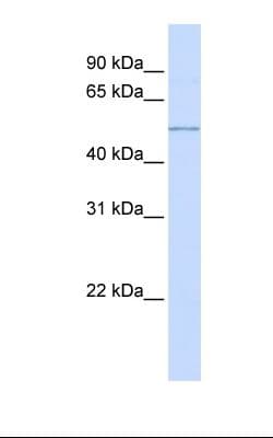 Polyclonal Rabbit anti-Human NR1H3 / LXR Alpha Antibody (C-Terminus, IHC, WB)