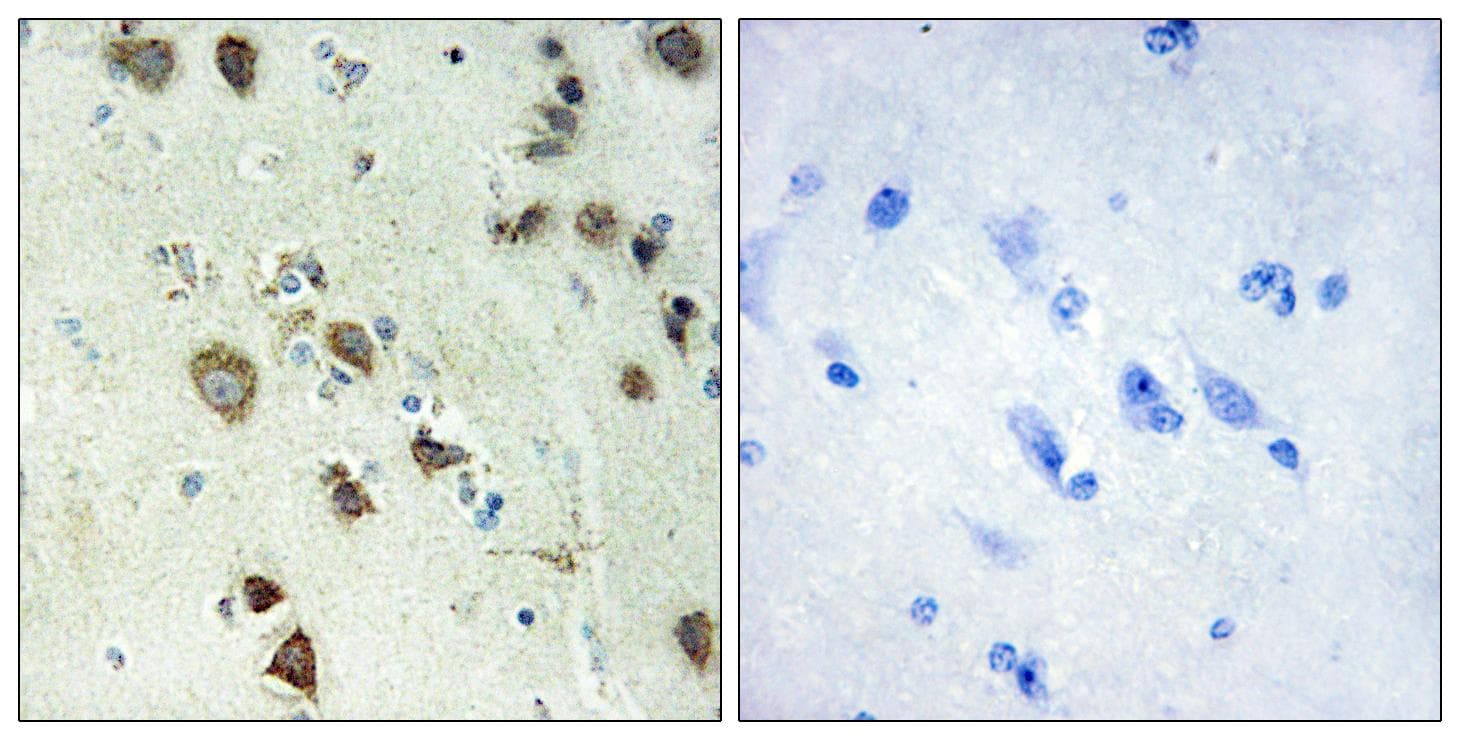 RPS6KA6 / RSK4 Antibody