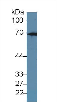 KRT2 / CK2 / Cytokeratin 2 Antibody (aa508-685)
