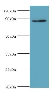 IHC-plus™ CDH11 / Cadherin 11 Antibody (aa637-796)