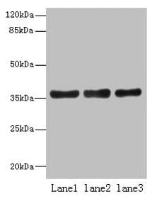 Polyclonal Rabbit anti-Human UP2 / UPP2 Antibody (WB)