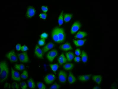 Polyclonal Rabbit anti-Human TRPM3 Antibody (IF)
