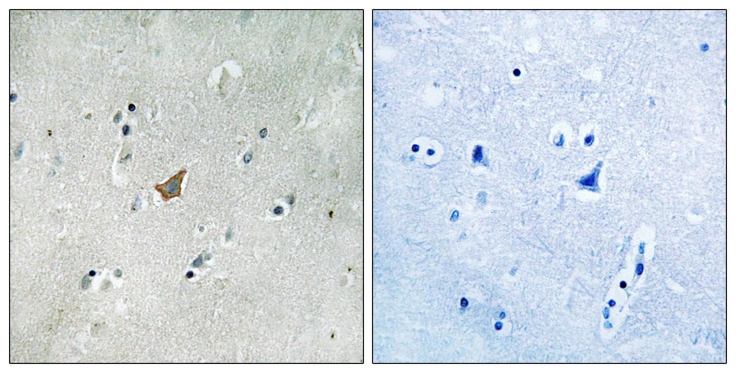 Polyclonal Rabbit anti-Human EPHA3 + EPHA4 + EPHA5 Antibody (phospho-Tyr779/833, IHC)