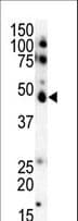 Polyclonal Rabbit anti-Human CSNK1E / CK1 Epsilon Antibody (aa331-360, IHC, WB)