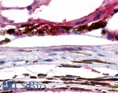 PathPlus™ GPR143 Antibody (C-Terminus)