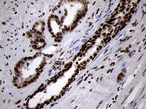 SMC1A / SMC1 Antibody (aa889-1016, clone OTI3G4, Carrier-free)