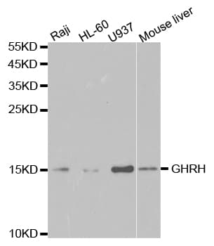 Polyclonal Rabbit anti-Human GHRH Antibody (IHC, WB)