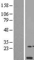 Human NDUFA11 / B14.7 Protein (Over-Expression Lysate Myc-DDK (Flag))