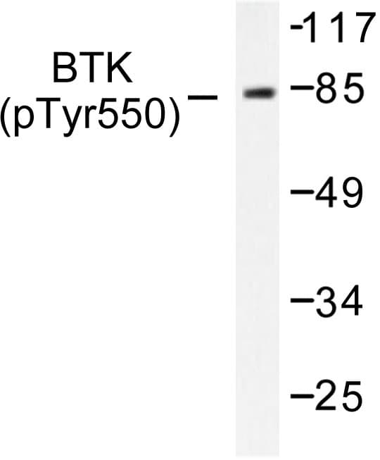 Polyclonal Rabbit anti-Human BTK Antibody (phospho-Tyr551, WB)