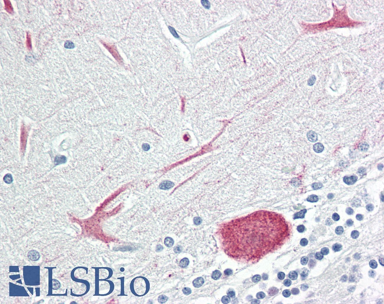 IHC-plus™ ARRDC2 Antibody (aa141-190)