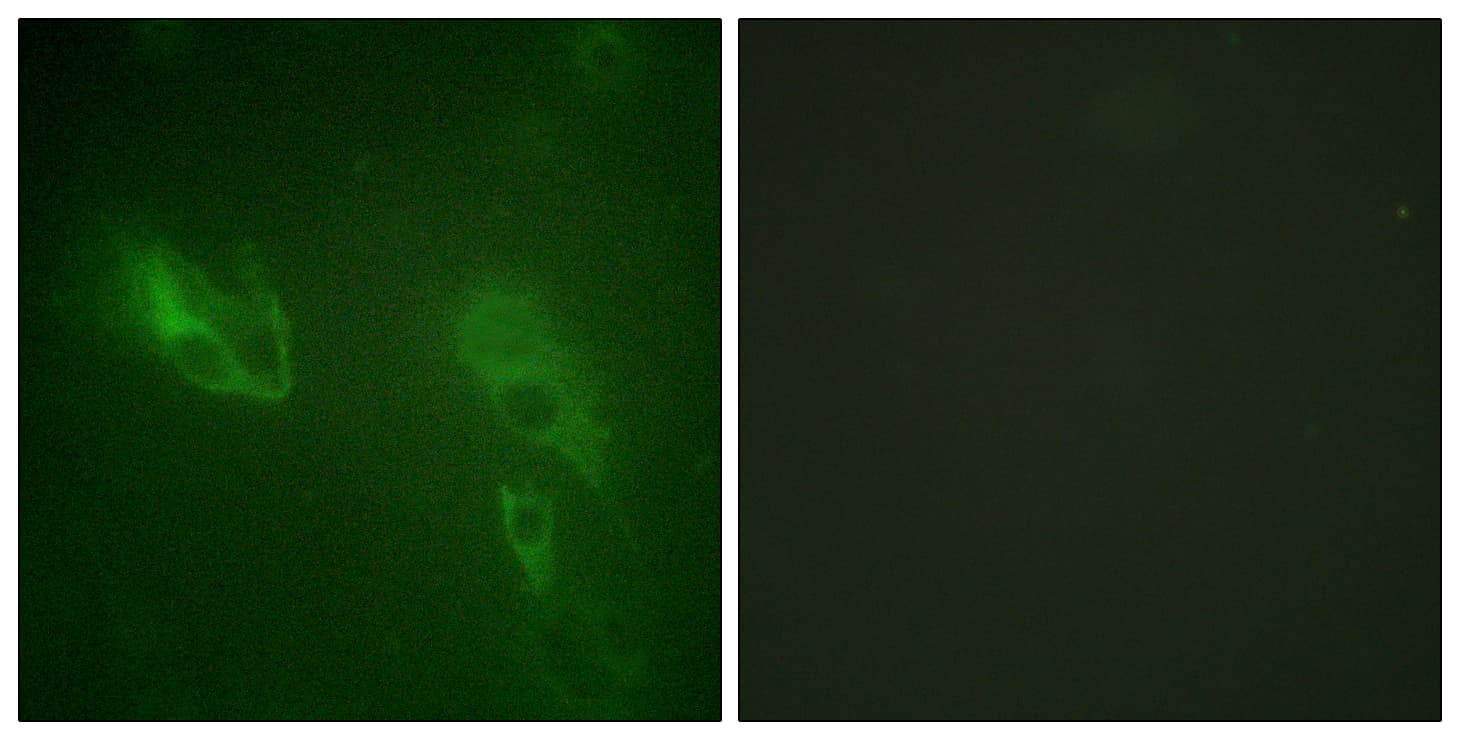 INSR / Insulin Receptor Antibody (aa881-930)