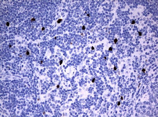 Monoclonal Mouse anti-Human PBX1 Antibody (clone UMAB111, IHC, IF)
