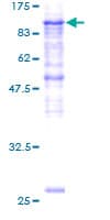 Human PLOD2 Protein (Recombinant GST)