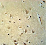PPP2R3C Antibody (aa50-79)