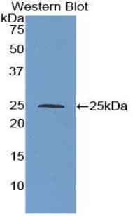 TIMP3 Antibody (aa20-211)