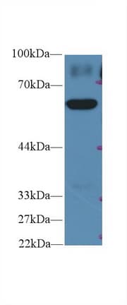 PKM / Pyruvate Kinase, Muscle Antibody (aa324-531)