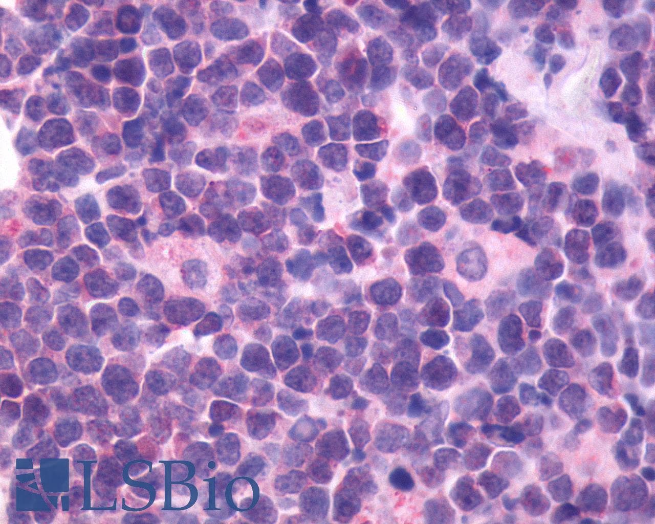 IHC-plus™ Polyclonal Rabbit anti-Human CXCR5 Antibody (C-Terminus, IHC)
