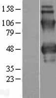 Properdin / CFP Protein (Over-Expression Lysate Myc-DDK (Flag))