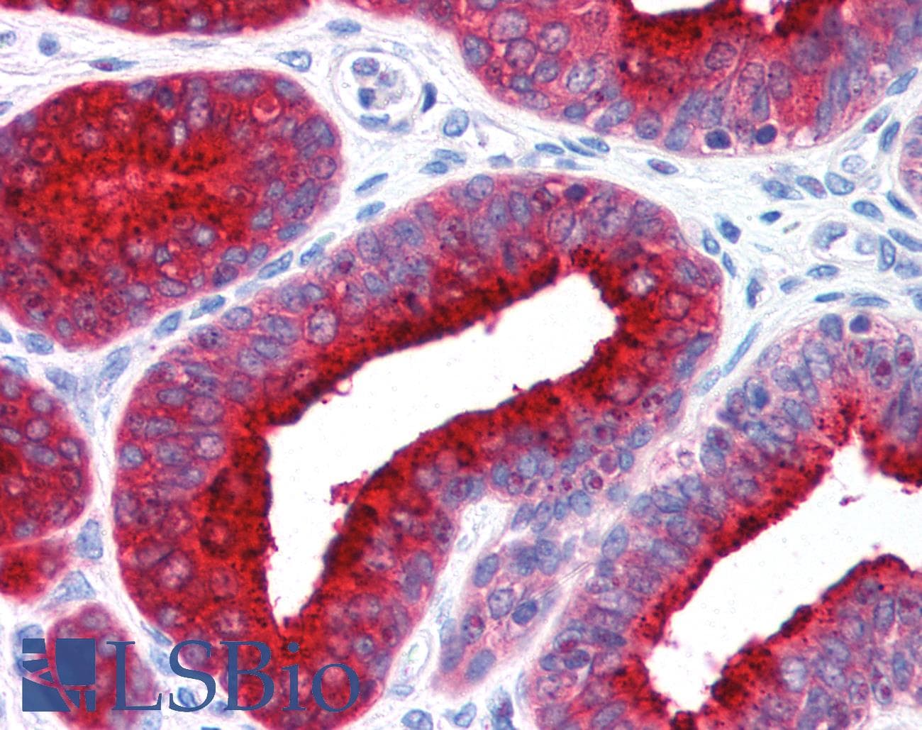 IHC-plus™ ADRBK1 / GRK2 Antibody (clone 5D5)