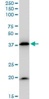 IHC-plus™ BAG1 / BAG-1 Antibody (clone 2D3)