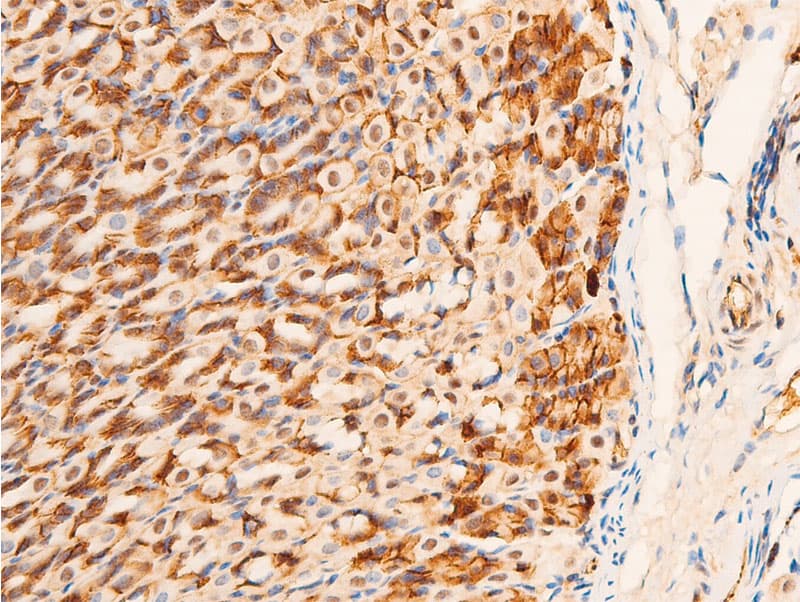 JUN / c-Jun Antibody (phospho-Ser63)