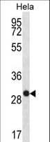 IHC-plus™ PS20 / WFDC1 Antibody (aa148-177)