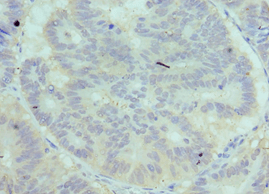 Complement C7 Antibody (aa22-270)