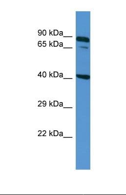 Polyclonal Rabbit anti-Human ZDHHC11B Antibody (N-Terminus, WB)