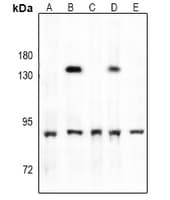 Polyclonal Rabbit anti-Human NAK / TBK1 Antibody (WB)