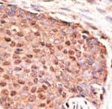ZMIZ1 Antibody (aa1038-1067)