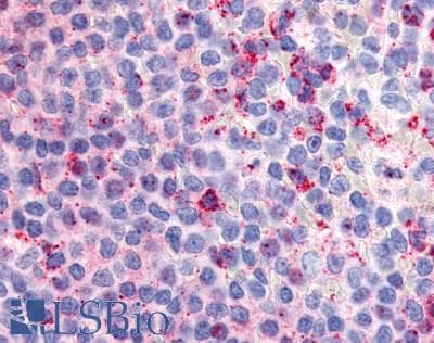 IHC-plus™ Polyclonal Rabbit anti-Human GPR132 / G2A Antibody (Extracellular Domain, IHC)