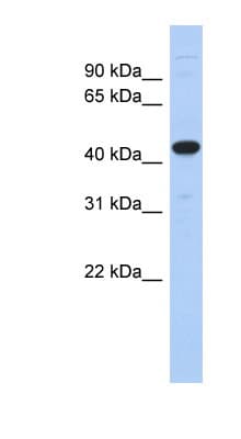 UBA3 / UBE1C Antibody (aa35-84)