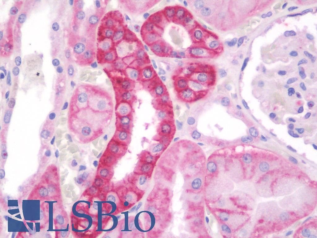 IHC-plus™ RAB8A / RAB8 Antibody (C-Terminus)