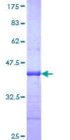 Human ABCA4 Protein (Recombinant GST, N-terminus)