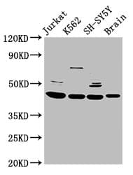 HOXD3 Antibody