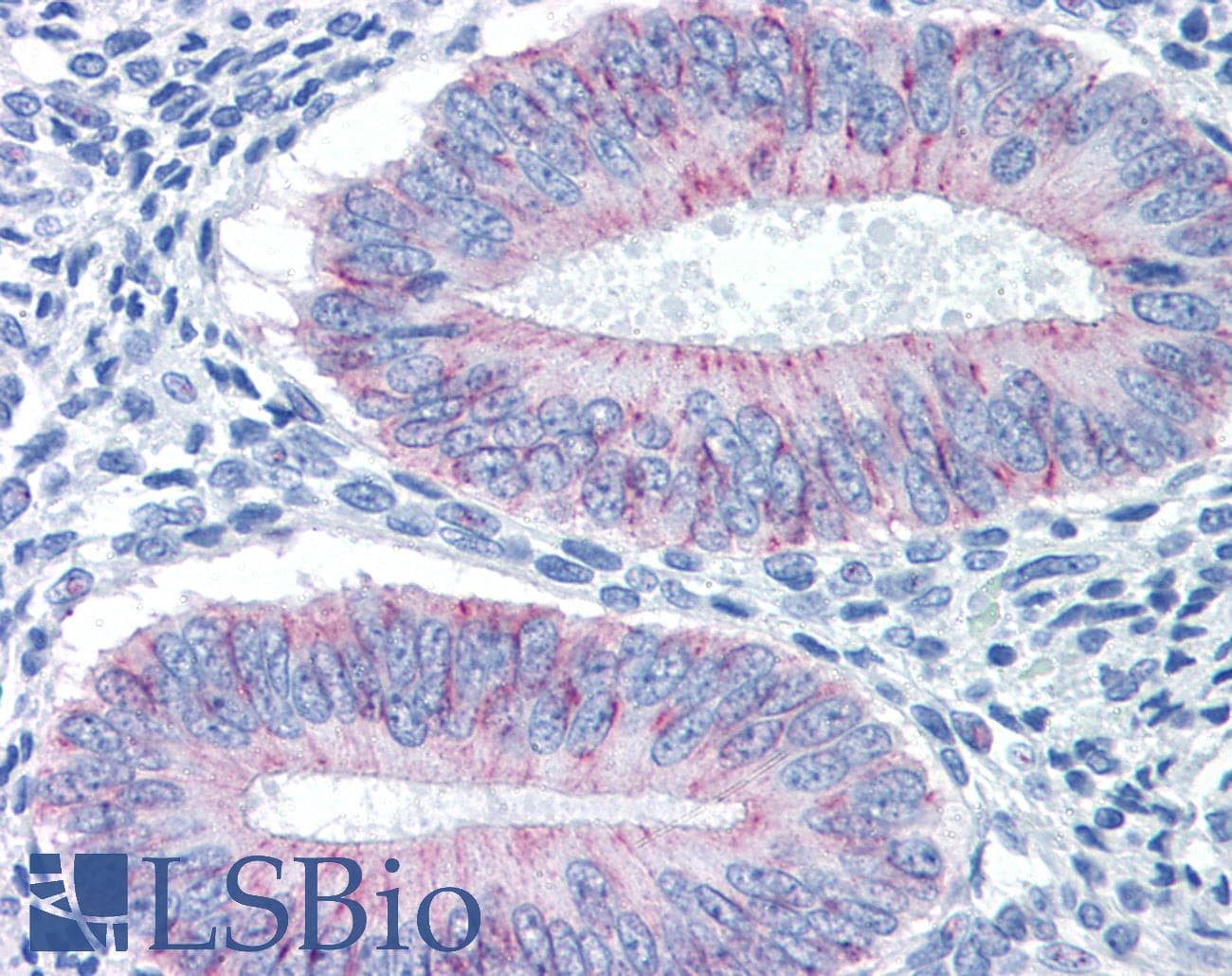 IHC-plus™ CLDN1 / Claudin 1 Antibody (clone 1C5-D9)