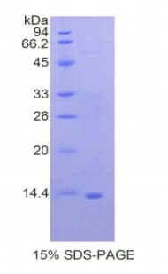 Human LF / LTF / Lactoferrin Protein (Recombinant His)