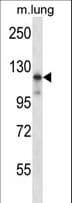 MAP3K14 Antibody (aa652-680)