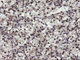 Mannose Phosphate Isomerase Antibody (clone OTI4G7)