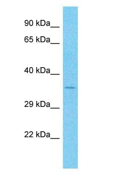 SEC14L2 Antibody (aa168-217)
