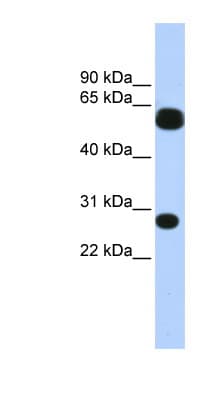 Polyclonal Rabbit anti-Human TRIM16 Antibody (aa36-85, WB)