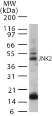 IHC-plus™ MAPK9 / JNK2 Antibody (aa373-389)