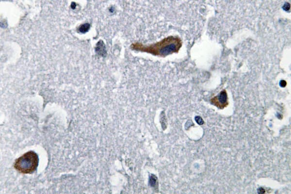 MAP2 Antibody (aa14-63)