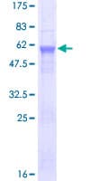 Human ADH6 Protein (Recombinant GST)