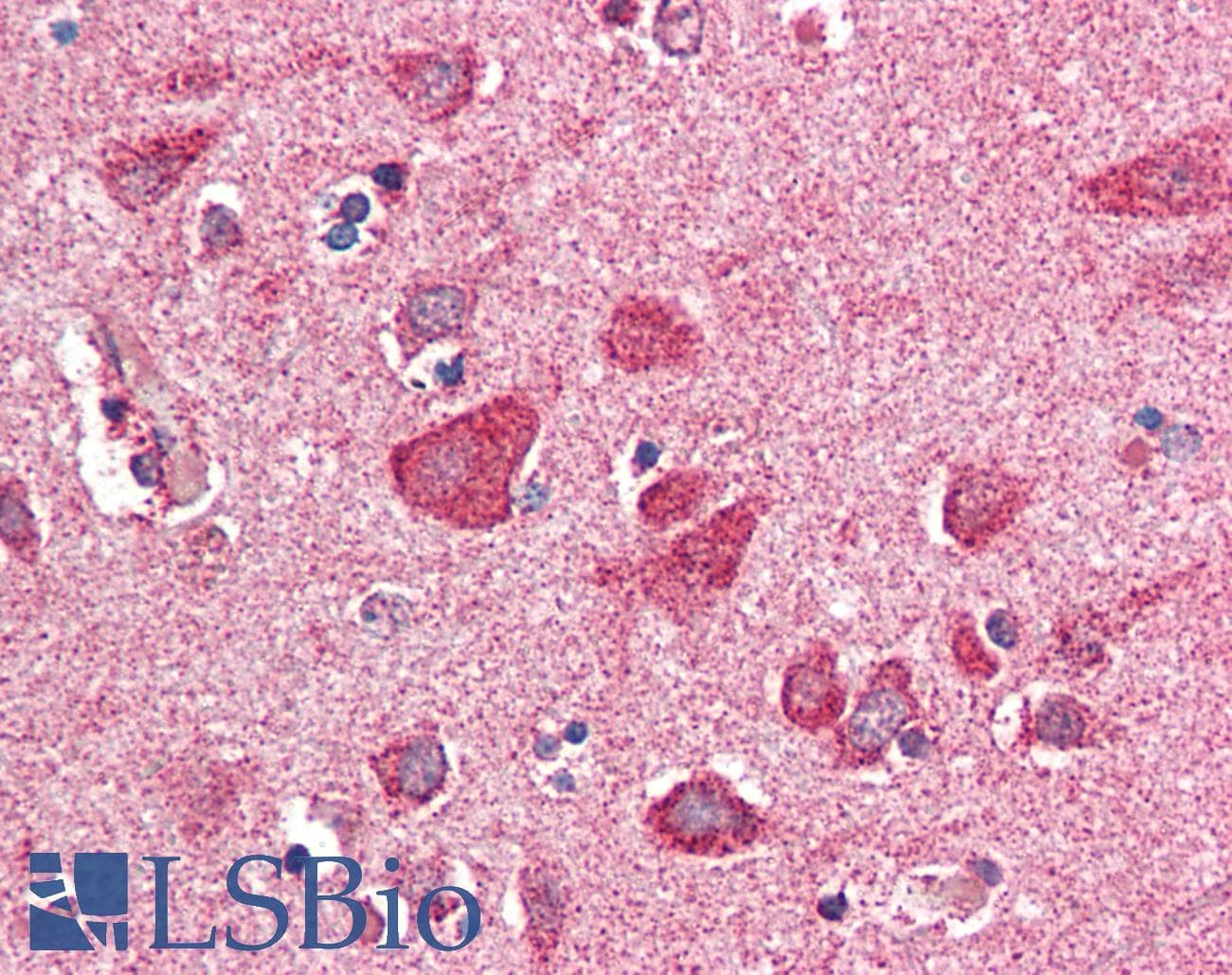IHC-plus™ PITPNM3 / NIR1 Antibody (aa962-974)