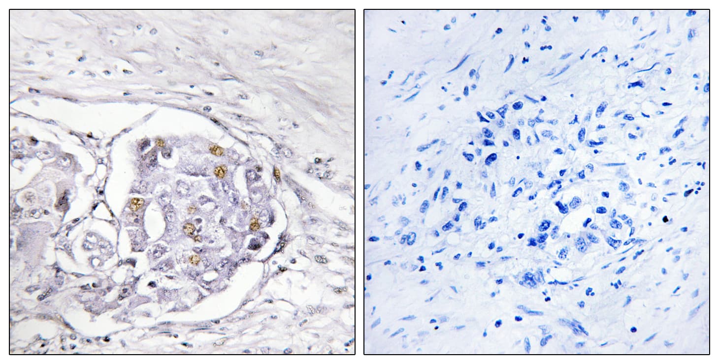 Polyclonal Rabbit anti-Human PR / Progesterone Receptor Antibody (aa261-310, IHC, IF)